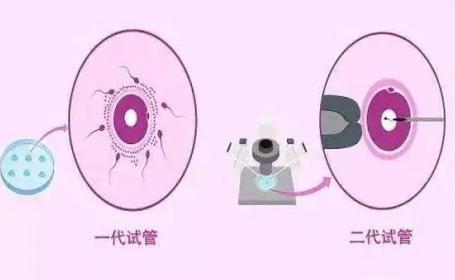 广州第二代试管婴儿多少钱